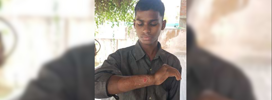 Appeal for Karteek – A Young Brother in Need